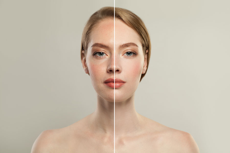 Laser Toning​