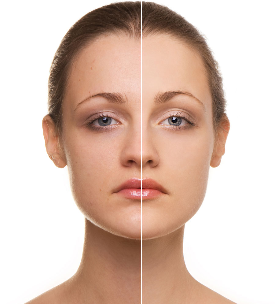 anti aging