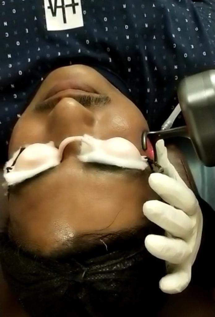 Laser_Rejuvenation